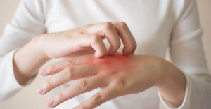 Why Use Eczema-Friendly Products For Sensitive Skin?